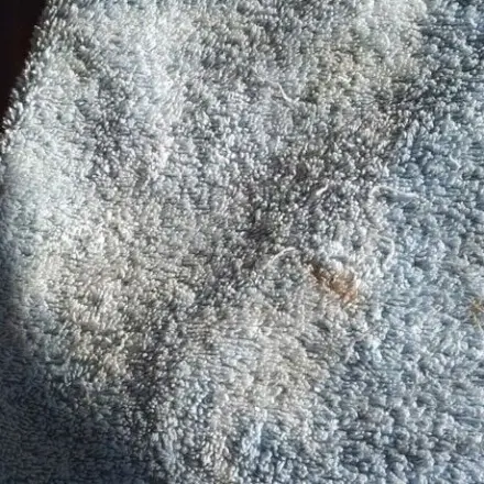 Sonne gegen Karottenflecken