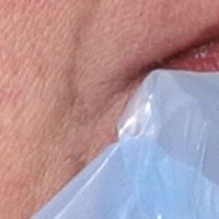 Kälte gegen Herpes