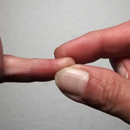 Fingerkuppendrücken gegen Schluckauf