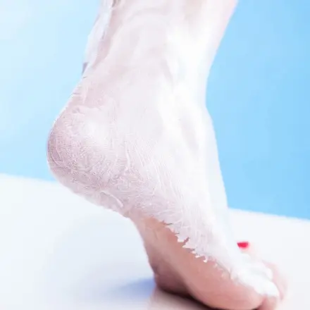 Rissige Fersen eincremen