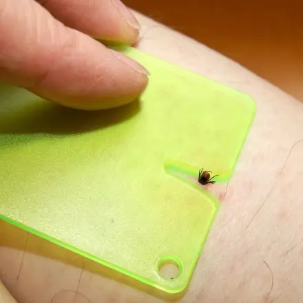 Was tun gegen Zecken?