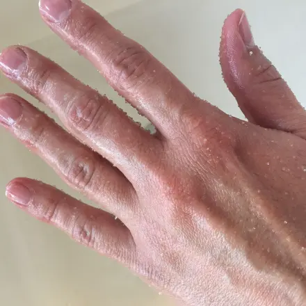 Hände Peeling leicht gemacht