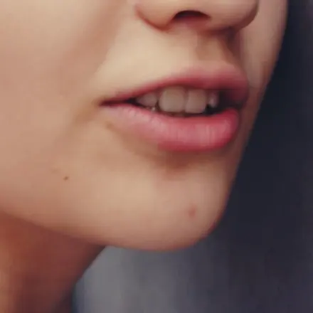 Herpes: Was man dagegen tun kann