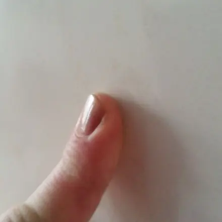 Tipps gegen brüchige Fingernägel