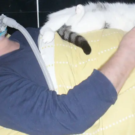 Ursachen und Folgen der Schlafapnoe