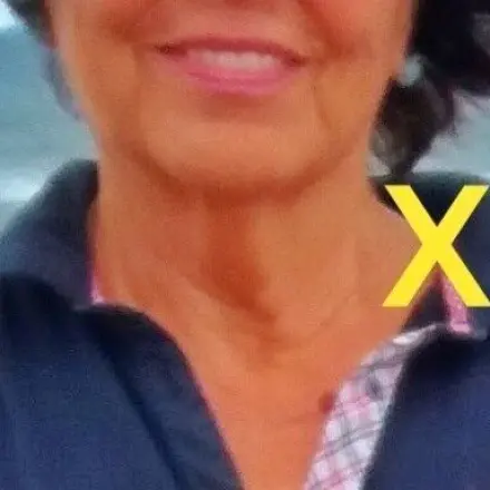 Halsschlagader ab 50 untersuchen lassen