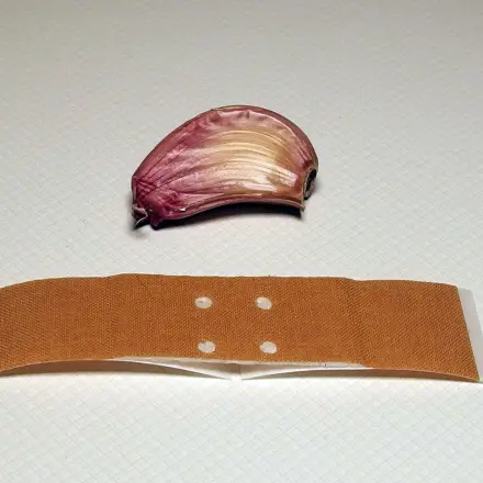 Mit Knoblauch gegen (Dorn)Warzen