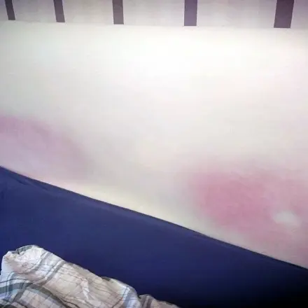 Verfärbungen auf Kunstleder entfernen