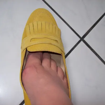 Endlich keine Blasen mehr an den Füßen