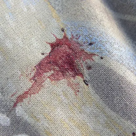 Blutfleck mit Garn entfernen