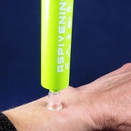 Schnelle Erste Hilfe bei Insektenstichen aller Art