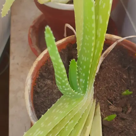 Aloe vera bei Verbrennungen