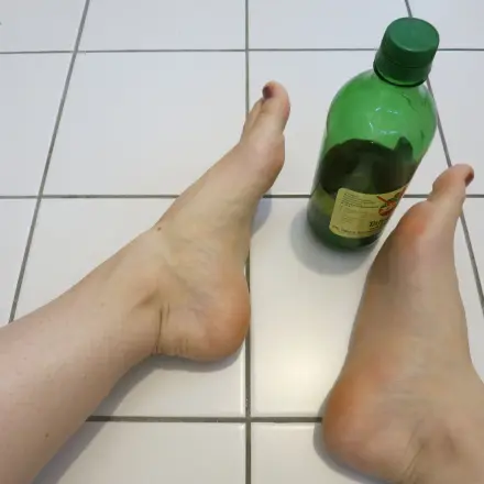 Günstige Abhilfe bei Fußpilz - Essigbad