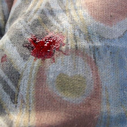 Salz gegen Blutflecken