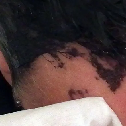 Haare färben - Ränder entfernen mit Babyfeuchttüchern