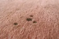 Flecken auf Teppichen entfernen