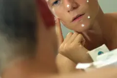 Vitamin B5 und Cordes BPO gegen Pickel & Akne