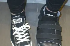 Hallux valgus: Besser laufen durch Vortäuschung falscher Tatsachen