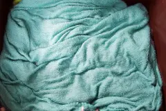 Blutflecken mit Sodawasser entfernen
