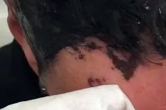 Haare färben - Ränder entfernen mit Babyfeuchttüchern